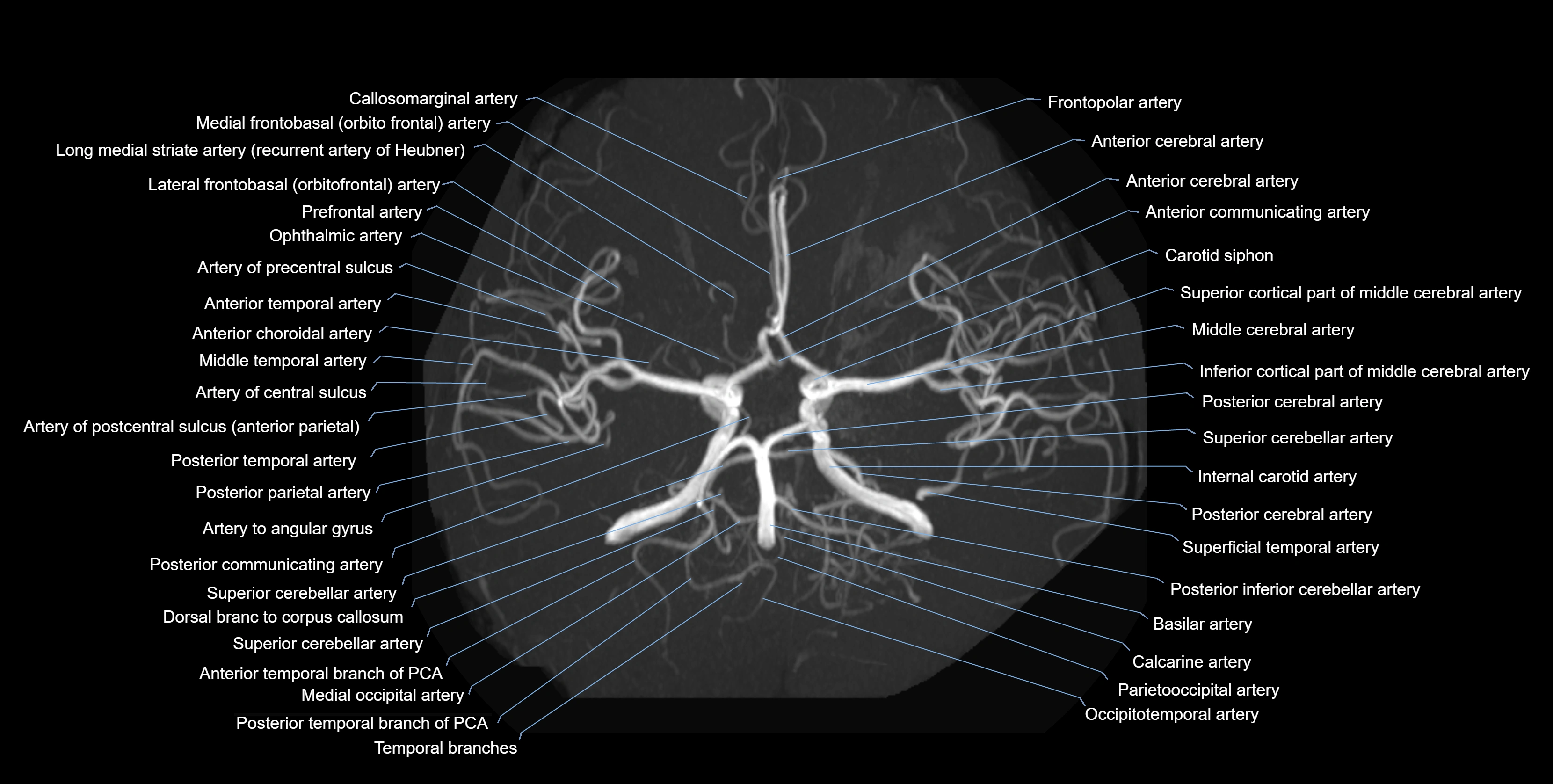 MRA brain axial MIP labelled  anatomy 3T MRI images -img-01021-00004.webp